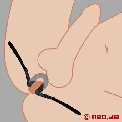 LaPorte Analspreizer 1 LaPorte Analspreizer